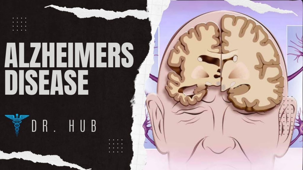 Scientists researching a cure for Alzheimer's disease in a laboratory in 2026