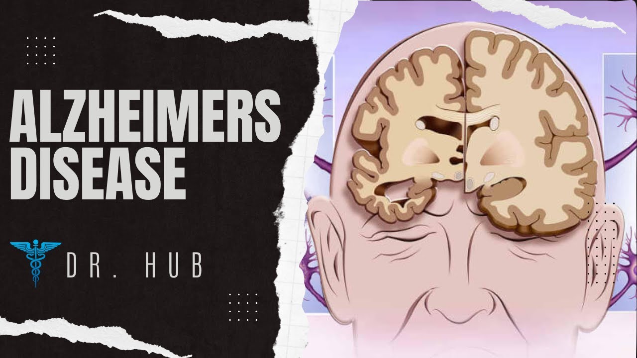 Scientists researching a cure for Alzheimer's disease in a laboratory in 2026