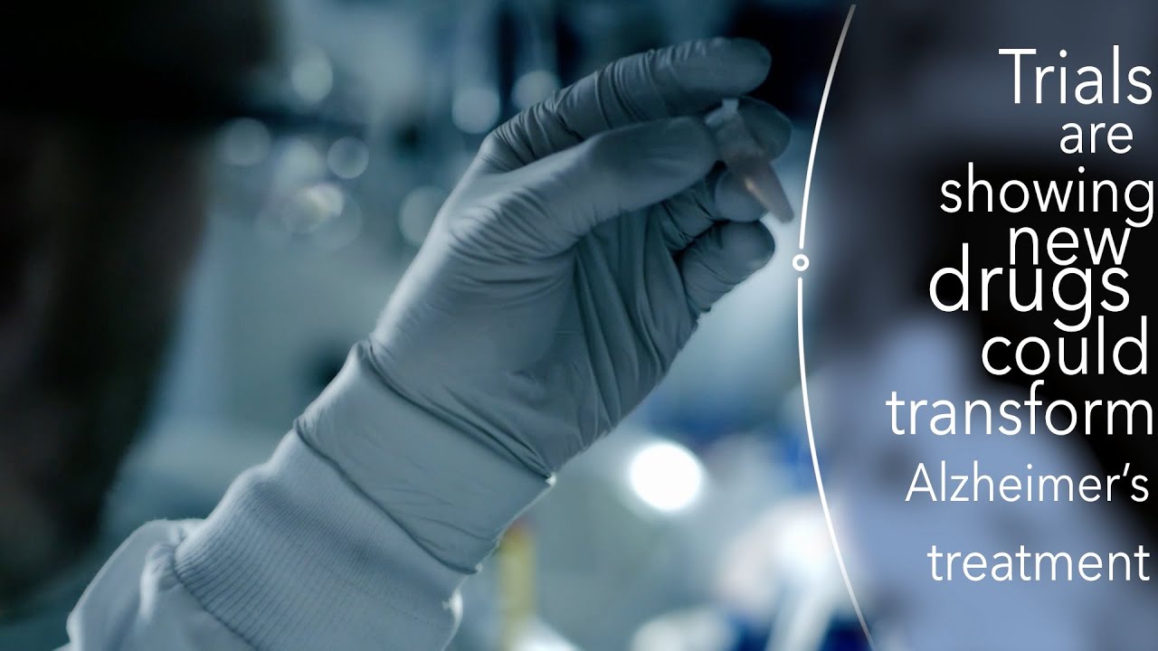 Scientist in laboratory researching a cure for Alzheimer's disease in 2026, studying brain scans and amyloid plaques