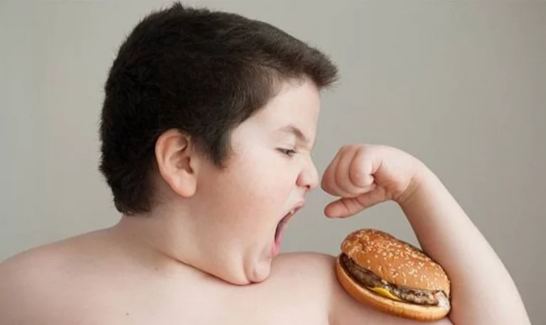 Italian teenager receiving treatment for severe obesity at a hospital in southern Italy.