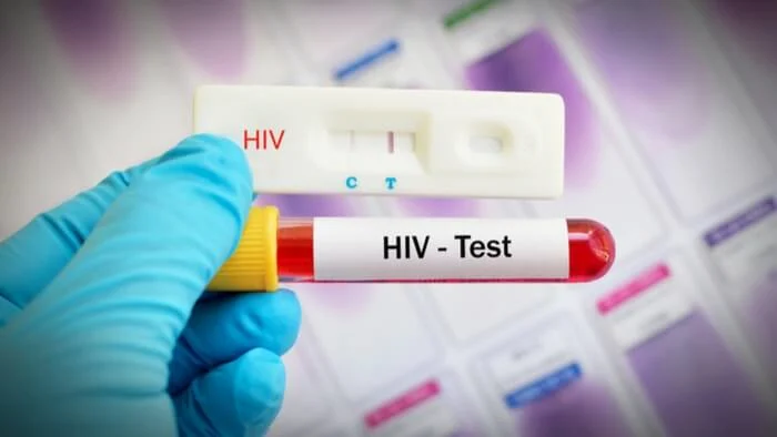 Laboratory technician holding a blood sample tube for an HIV screening test